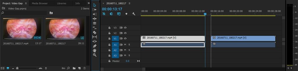 No video Gap